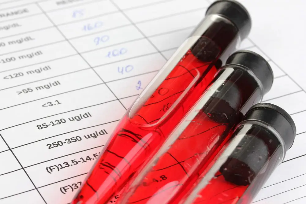 Résultats d'une analyse d'un complément alimentaire mené en laboratoire accompagnés de leur certification